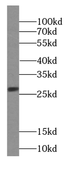 GCA Rabbit Polyclonal Antibody
