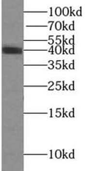 ADH5 Rabbit Polyclonal Antibody