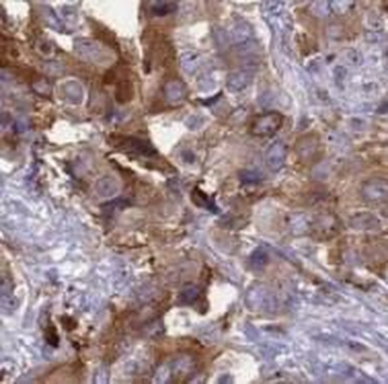 ADH5 Rabbit Polyclonal Antibody