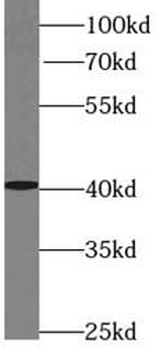 ADH5 Rabbit Polyclonal Antibody