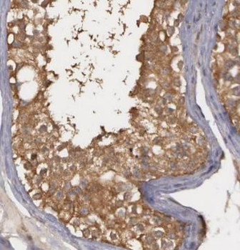 ADH5 Rabbit Polyclonal Antibody