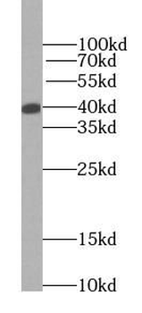 ADH5 Mouse Monoclonal Antibody