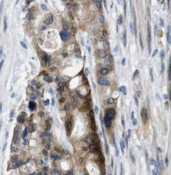 ADH5 Mouse Monoclonal Antibody