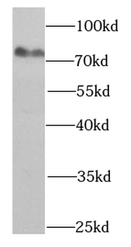 HADHA Mouse Monoclonal Antibody