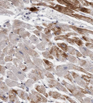 HADHA Mouse Monoclonal Antibody