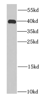 HDGF Mouse Monoclonal Antibody