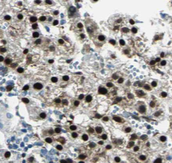 HDGF Mouse Monoclonal Antibody