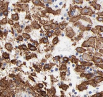 HBE1 Rabbit Polyclonal Antibody