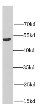 HERPUD1 Rabbit Polyclonal Antibody