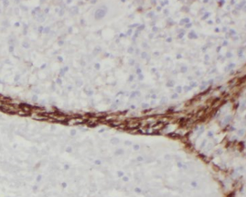 TGFB1I1 Rabbit Polyclonal Antibody