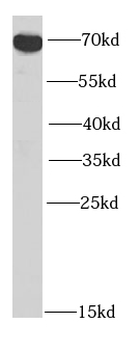 ZDHHC17 Rabbit Polyclonal Antibody