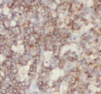 HLA A Mouse Monoclonal Antibody
