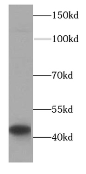 HLA-C Antibody