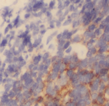 HLA-C Antibody