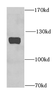 HDGFL2 Rabbit Polyclonal Antibody