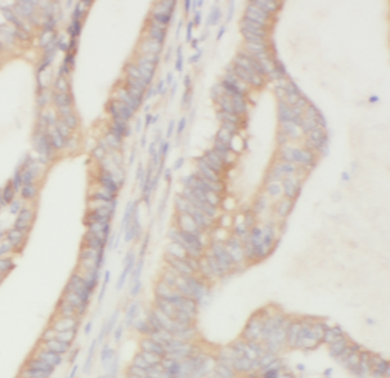 HDGFL2 Rabbit Polyclonal Antibody