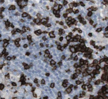 IFITM1 Specific Mouse Monoclonal Antibody