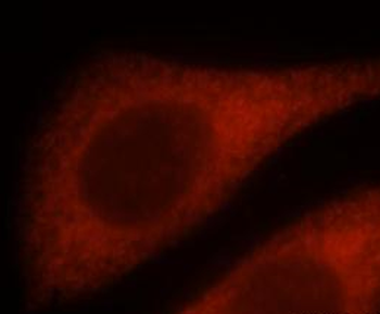 IFITM3 Mouse Monoclonal Antibody