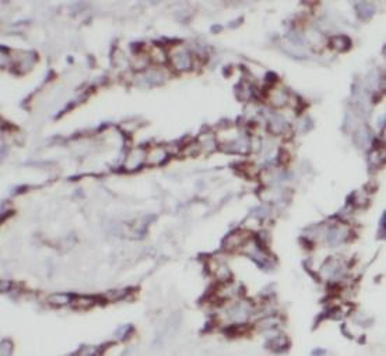 IFITM3 Mouse Monoclonal Antibody