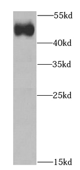 IFT52 Rabbit Polyclonal Antibody