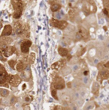 IGF2R Specific Rabbit Polyclonal Antibody