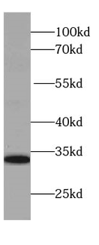 IL-28A Antibody