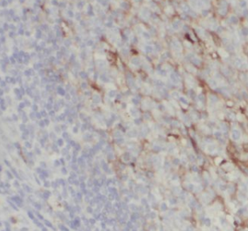 IL-28A Antibody