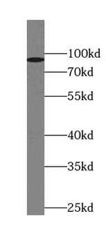KPNB1 Rabbit Polyclonal Antibody