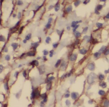 KPNB1 Rabbit Polyclonal Antibody