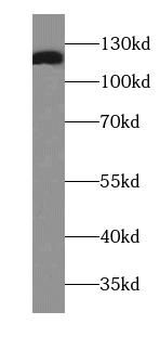 ITGA3 Rabbit Polyclonal Antibody