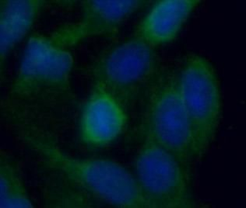 ITGA3 Rabbit Polyclonal Antibody