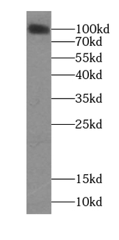 ITGA9 Rabbit Polyclonal Antibody