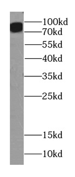 ITGB6 Specific Rabbit Polyclonal Antibody