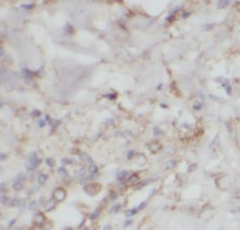 ITGB6 Specific Rabbit Polyclonal Antibody