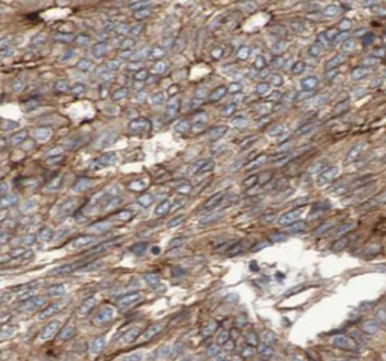 KLK11 Rabbit Polyclonal Antibody