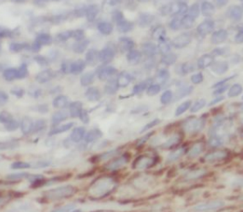 KLK5 Rabbit Polyclonal Antibody