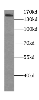 KDM3A Rabbit Polyclonal Antibody