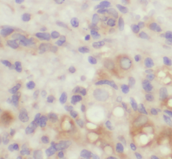 KDM3A Rabbit Polyclonal Antibody