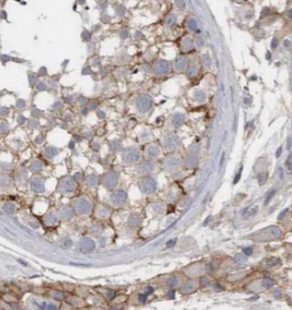 KIFAP3 Mouse Monoclonal Antibody
