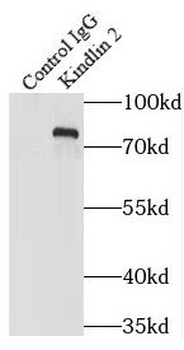 FERMT2 Rabbit Polyclonal Antibody