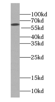 KNG1 Rabbit Polyclonal Antibody