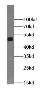 KCNJ8 Rabbit Polyclonal Antibody