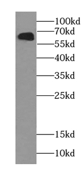 POGLUT1 Rabbit Polyclonal Antibody