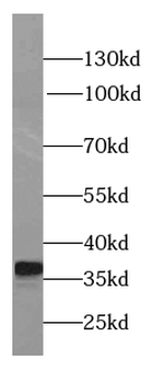 LDHB Antibody