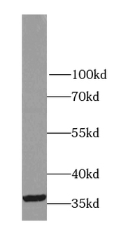 LDHC Specific Rabbit Polyclonal Antibody