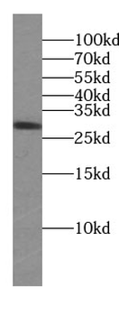 Lin28A specific Rabbit Polyclonal Antibody