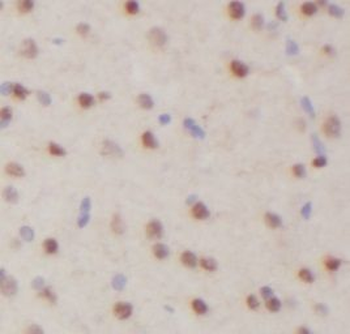 LIN28B specific Rabbit Polyclonal Antibody