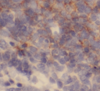 LCP1 Antibody