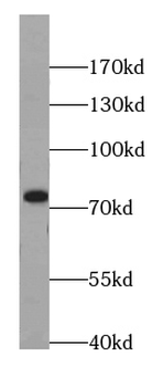 MTA2 Mouse Monoclonal Antibody