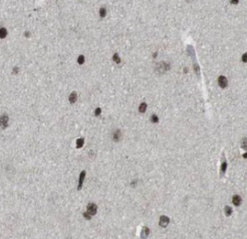 MTA2 Mouse Monoclonal Antibody